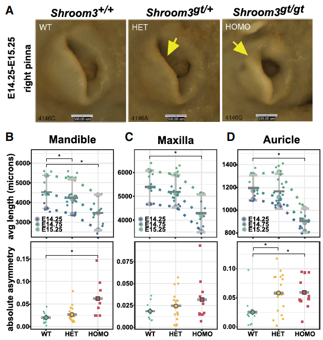 Shroom3 morphometrics image from Zhu et al 2025