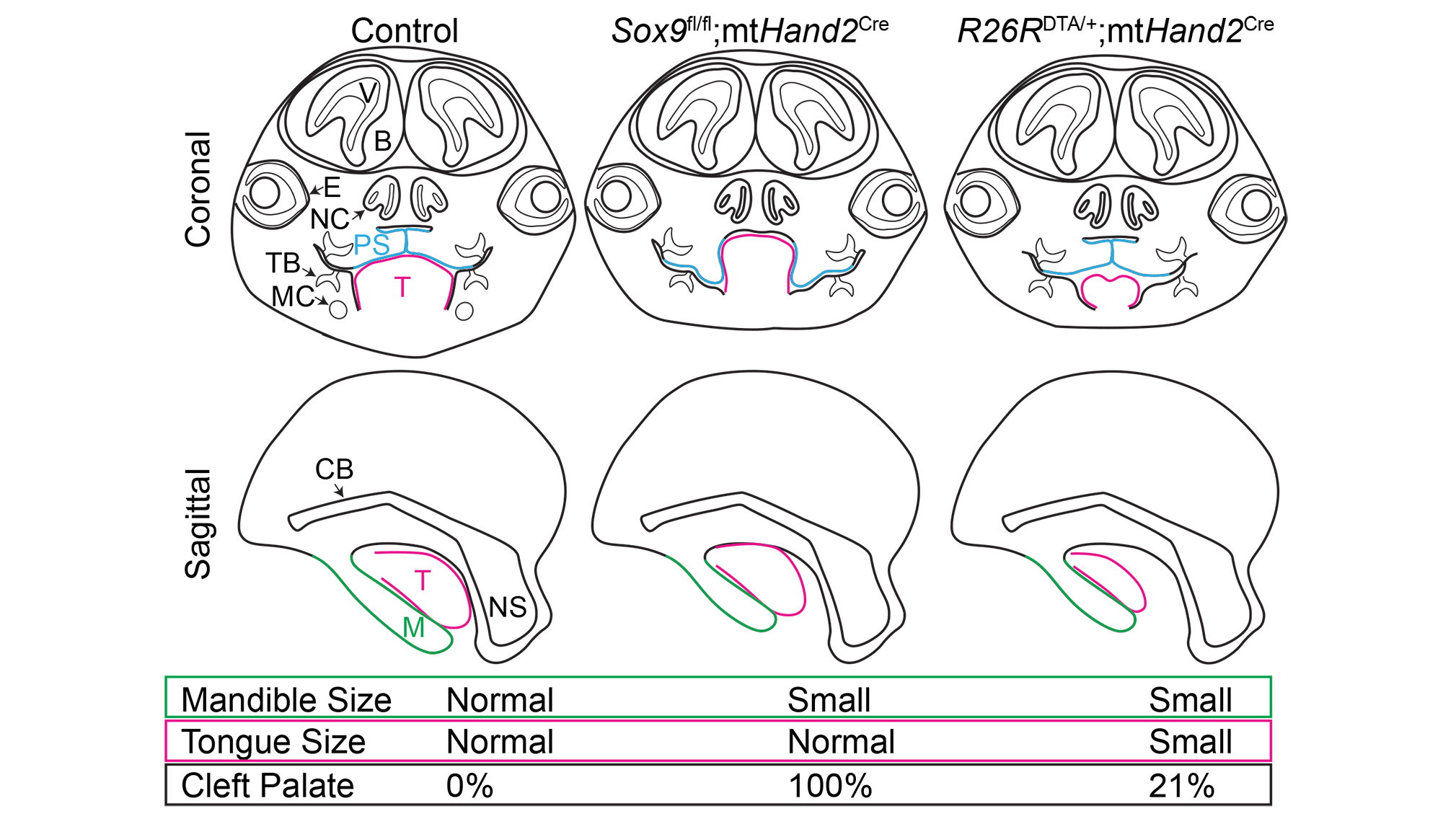 Comparison of palate outcomes in the Sox9fl/fl;mtHand2Cre Pierre Robin sequence model (left) and the DTA/+;mtHand2Cre micrognathia/microglossia model (right). Image courtesy of Alice Fitzgerald Goodwin.