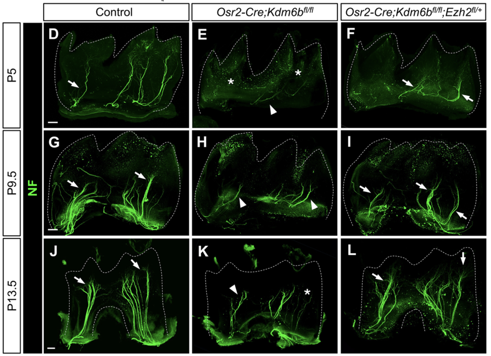 Neurofilament staining of molars at three postnatal stages comparing control, Kdm6b mutant, and Ezh2 haploinsufficient rescue mice, showing reduced axon entry into the dental pulp in mutants.