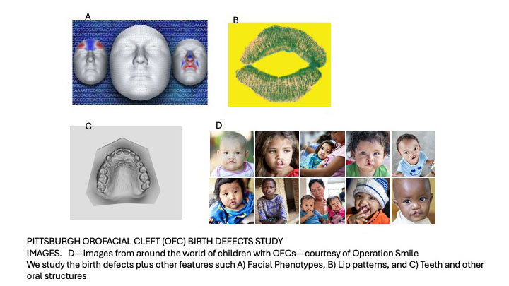 Images from the Pittsburgh Orofacial Cleft (OFC) Birth Defects Study